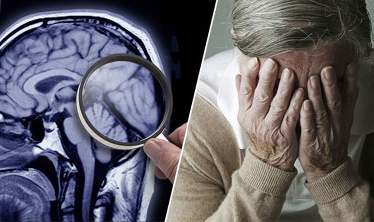 12 Early Dementia Signs and Symptoms that Shouldnât be Ignored
