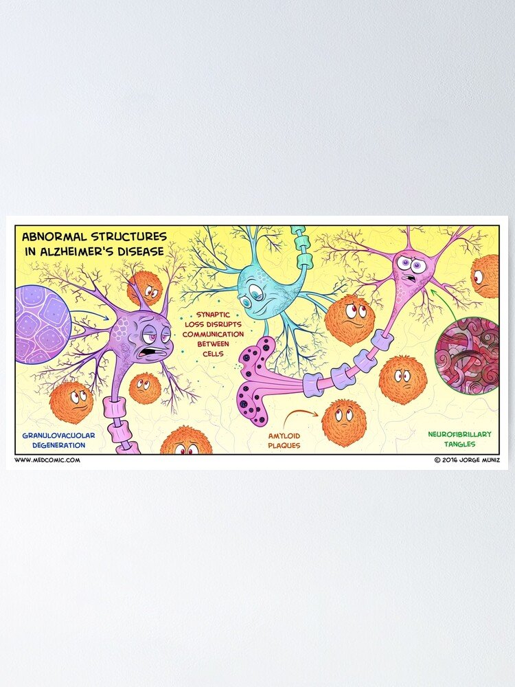 " Abnormal structures in Alzheimers disease"  Poster by ...