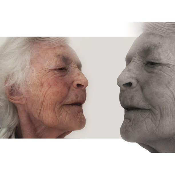 Age Old Woman Retirement Home Dementia Alzheimer