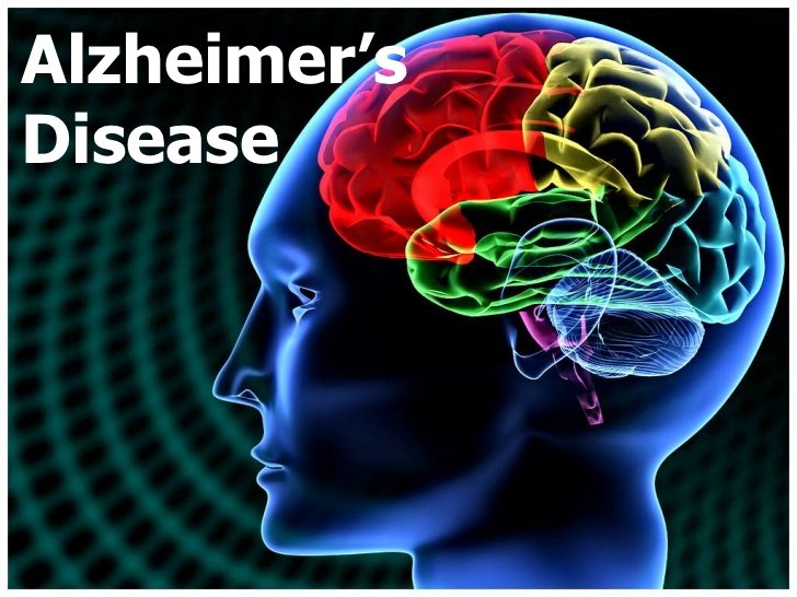 All You Need to Know About Alzheimerâs Disease ...