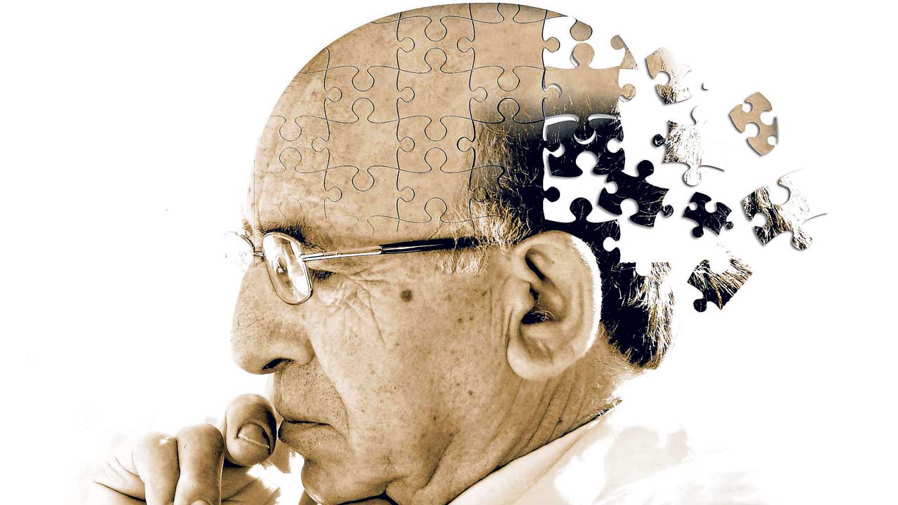 Alzheimer  Alzheimer