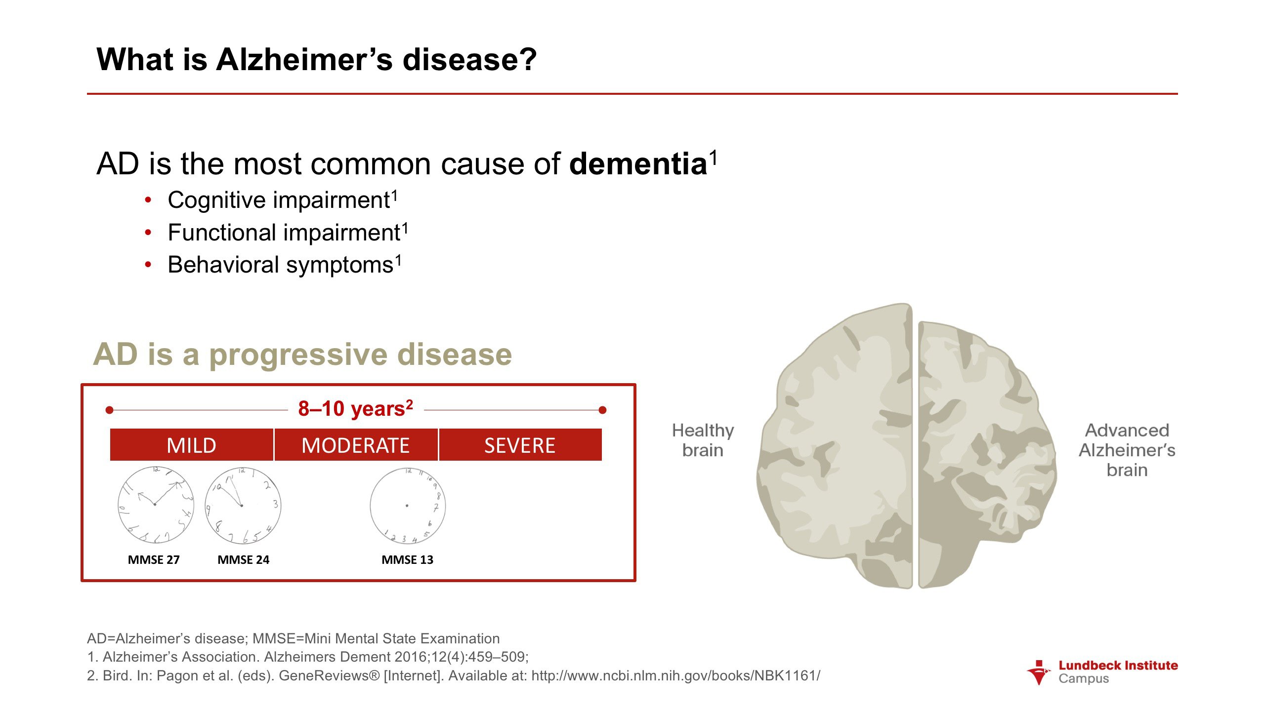 Alzheimer Epidemiology / Epidemiology Of Alzheimer S ...