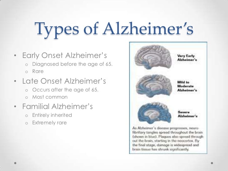 Alzheimer s disease_powerpoint_skinner_kassandra