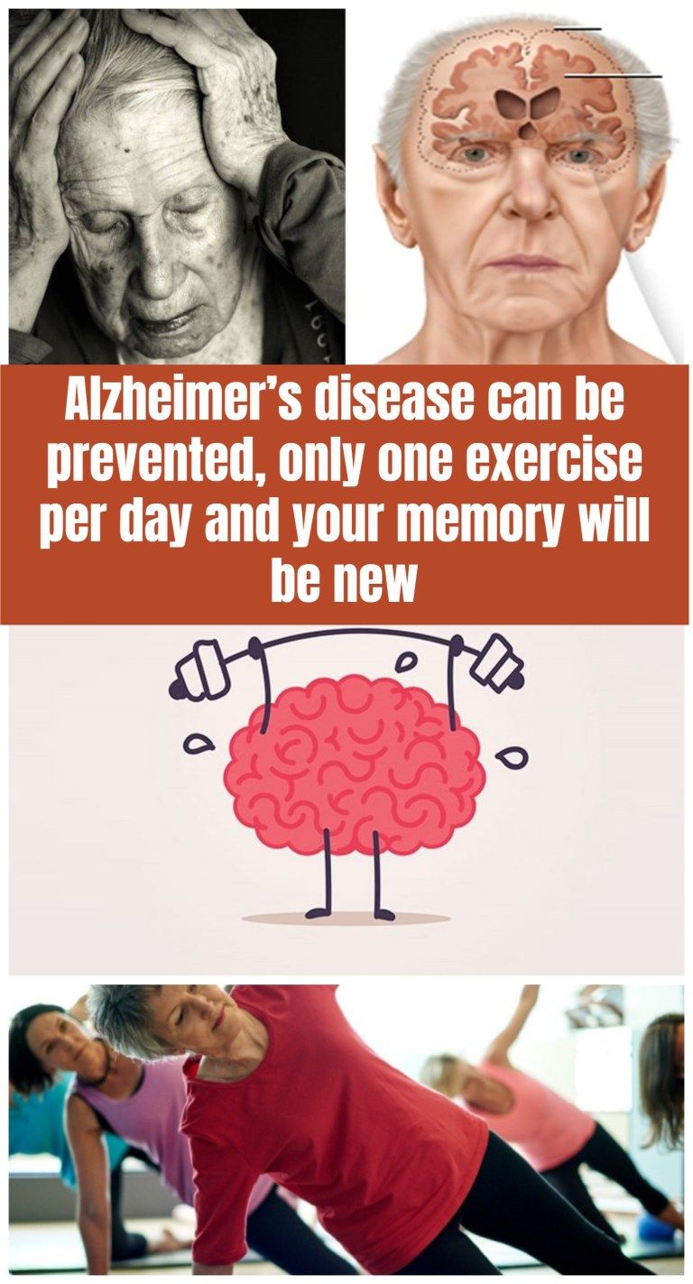 Alzheimers disease can be prevented, only one exercise ...