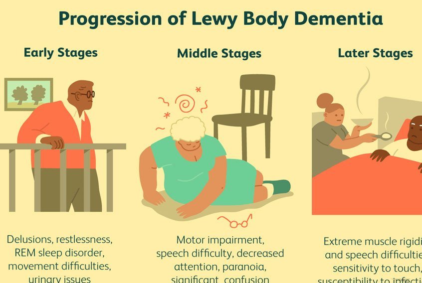 Amazing 20 Home Remedies For Dementia With Lewy Bodies