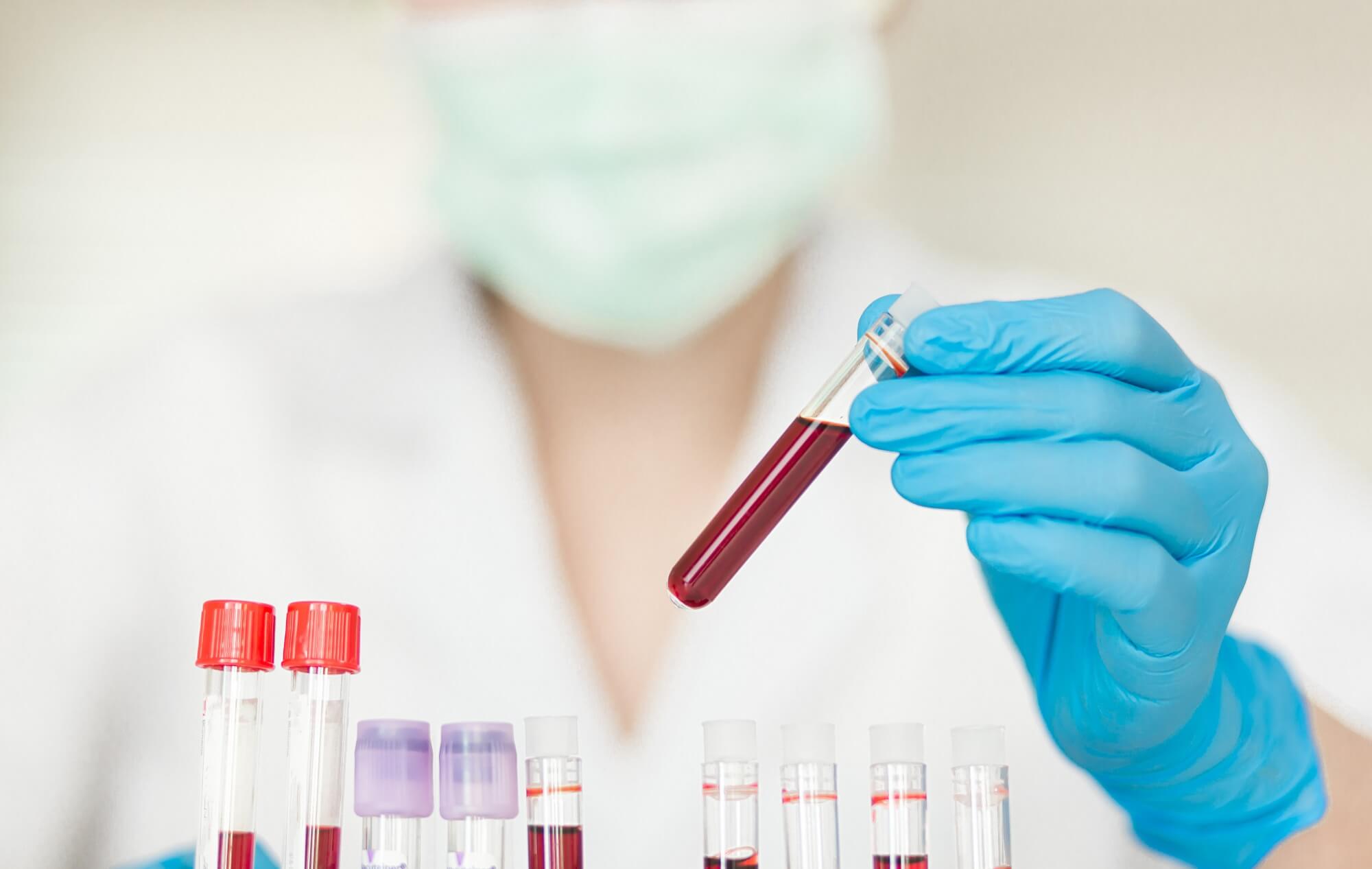 Blood test can diagnose people with Alzheimers disease