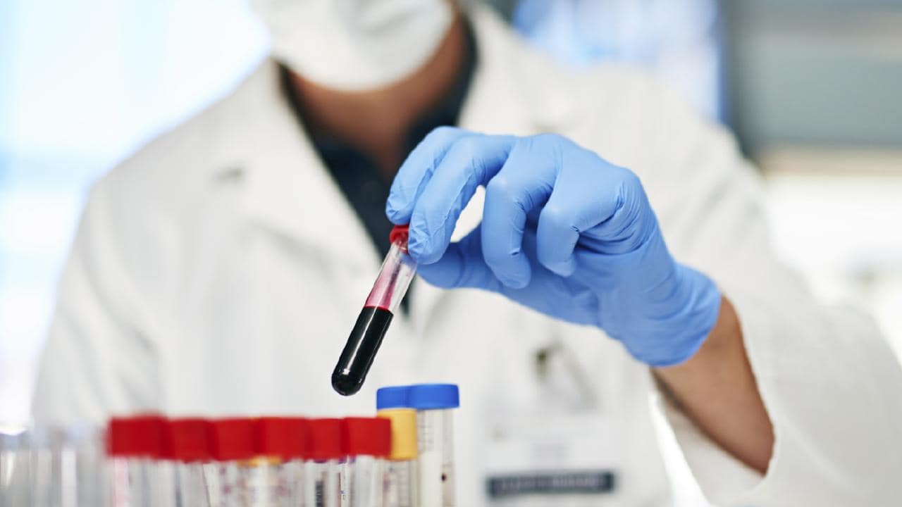 Blood test to diagnose Alzheimers disease