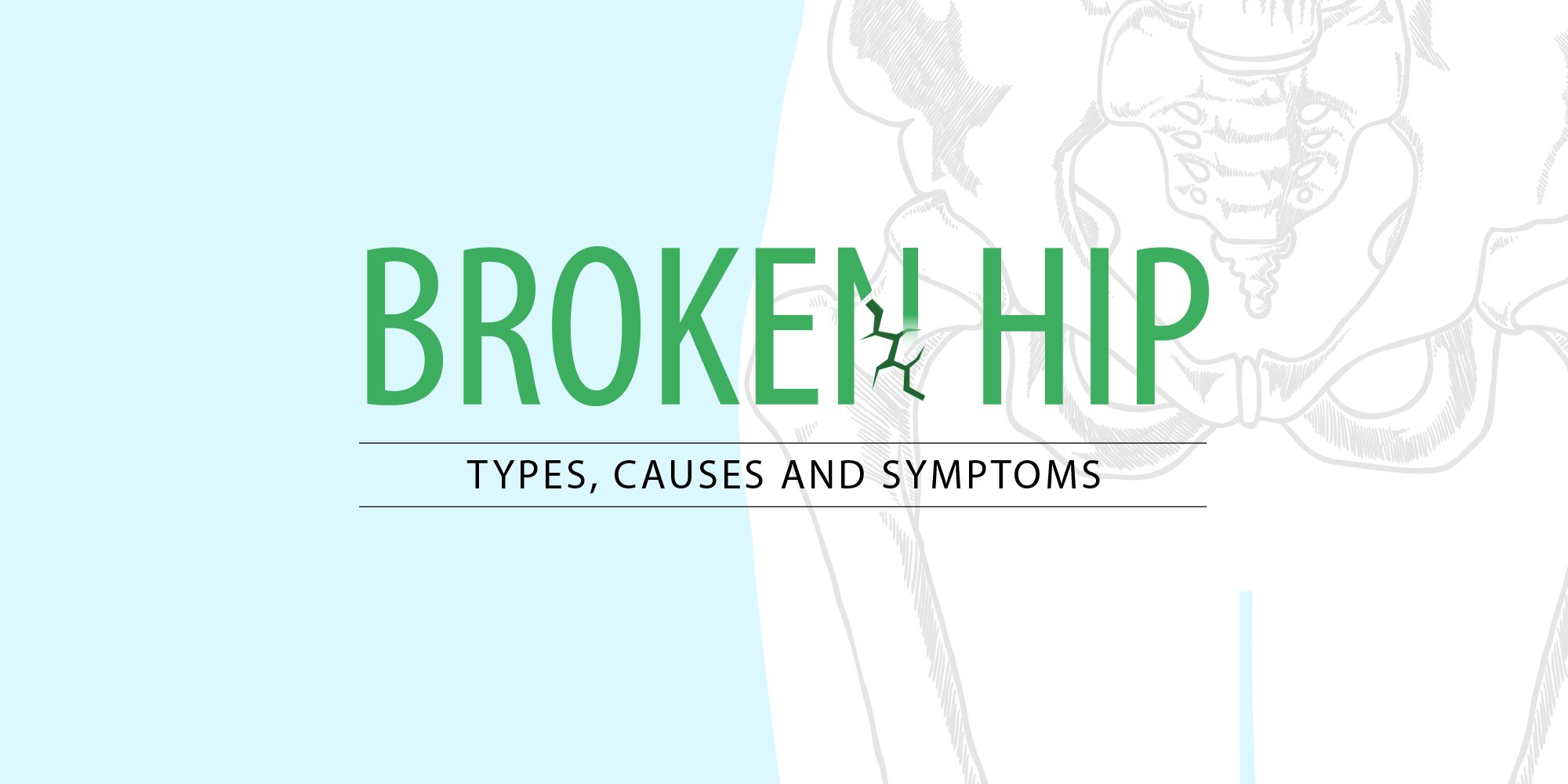 Broken Hip: Types, Causes and Symptoms