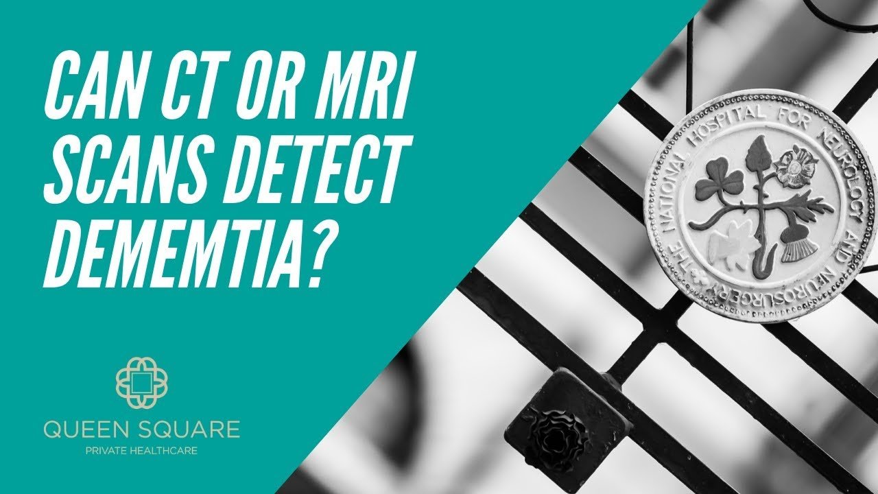 Can a CT or MRI scan detect dementia?