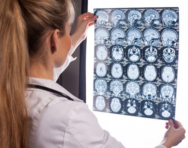 Can an MRI Detect Dementia?