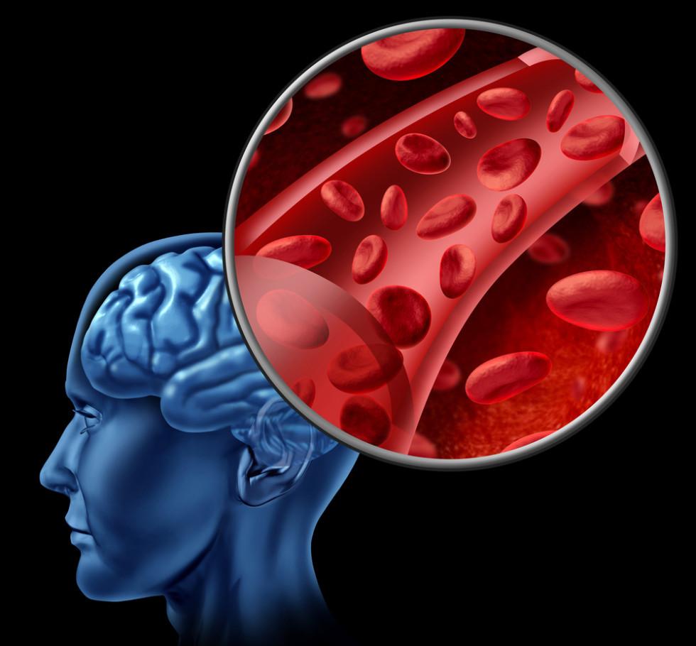 Can Young Blood Treat Alzheimerâs Disease?