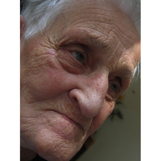 Dementia Age Old Woman Dependent Alzheimer