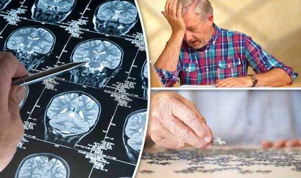 Dementia: Brain test for over