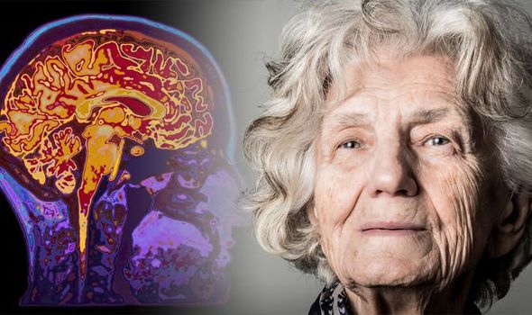 Dementia symptoms: Early signs of one of the most common ...