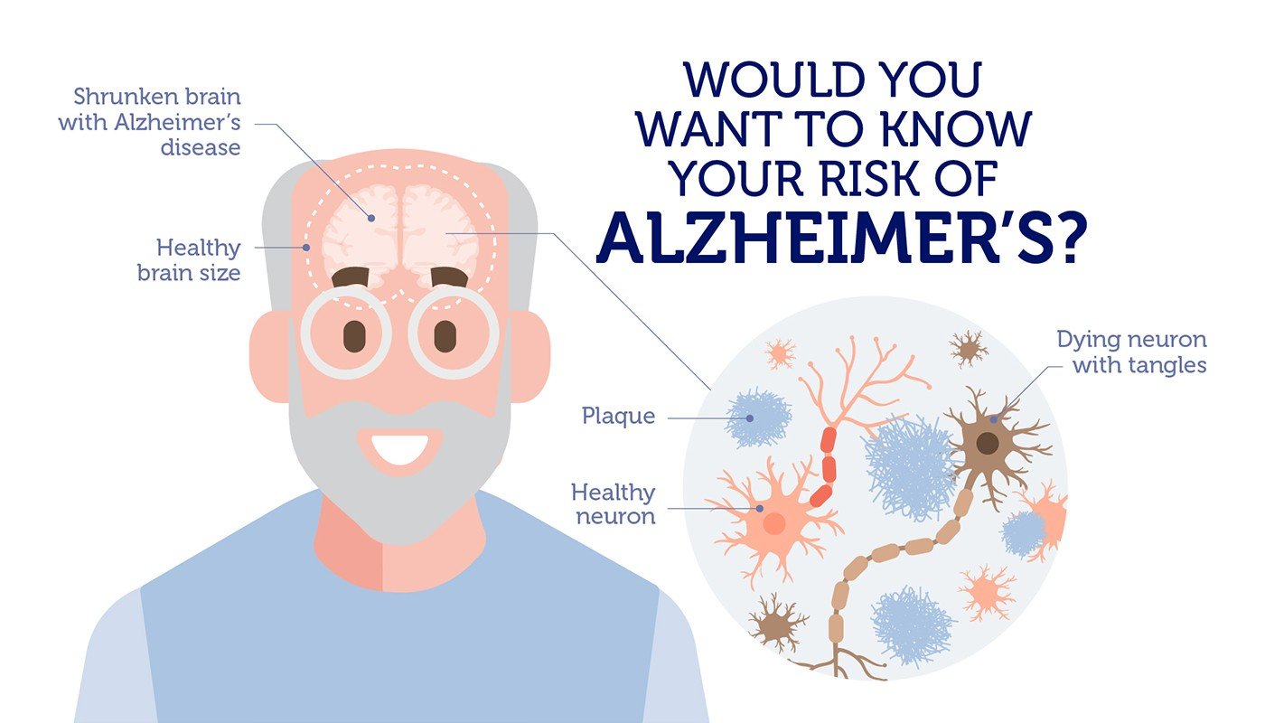 Did you know your risk of Alzheimers Disease is ...