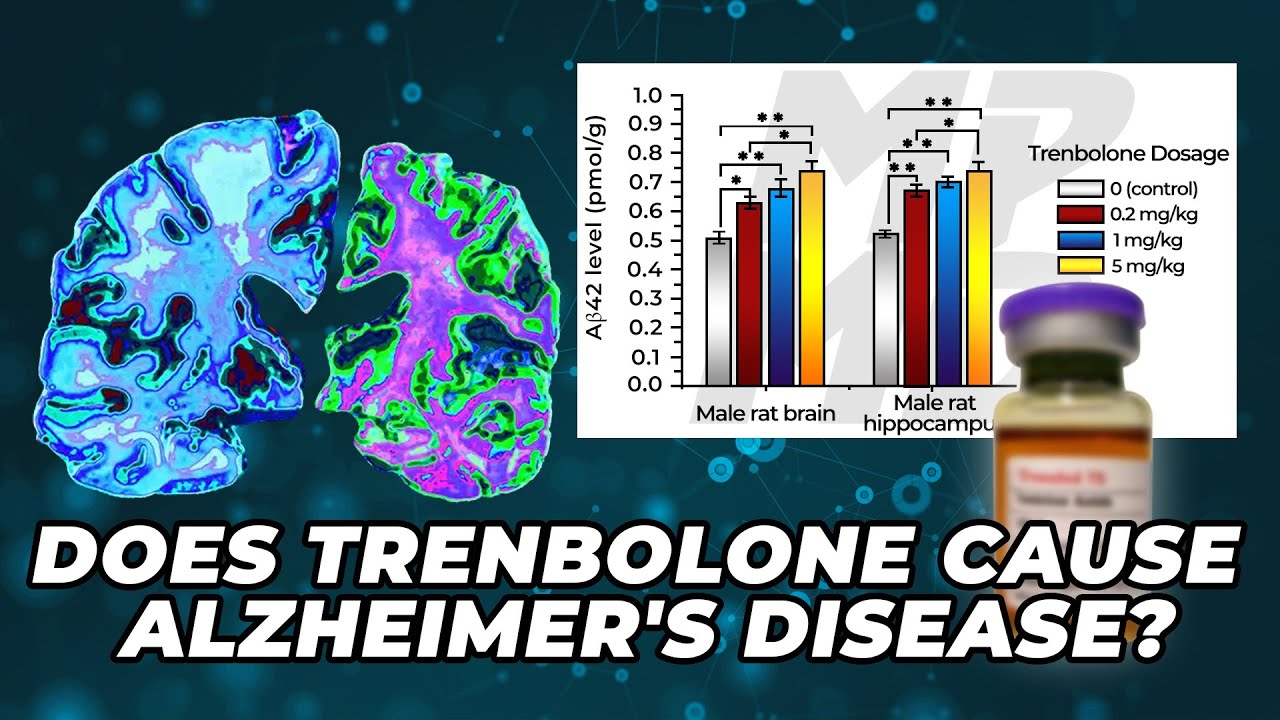 Does Trenbolone Cause Alzheimer