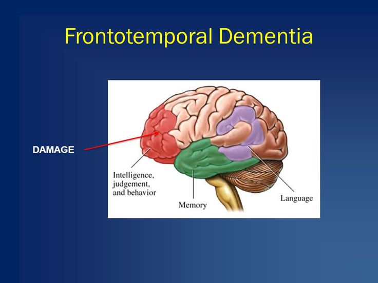 " Frontotemporal Dementia"  For any Queries &  Admission Call ...