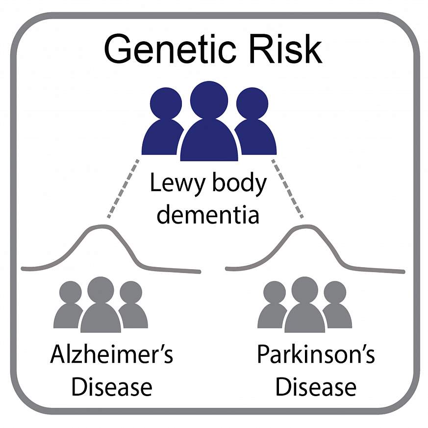 Genetic study of Lewy body dementia supports ties to Alzheimers and ...