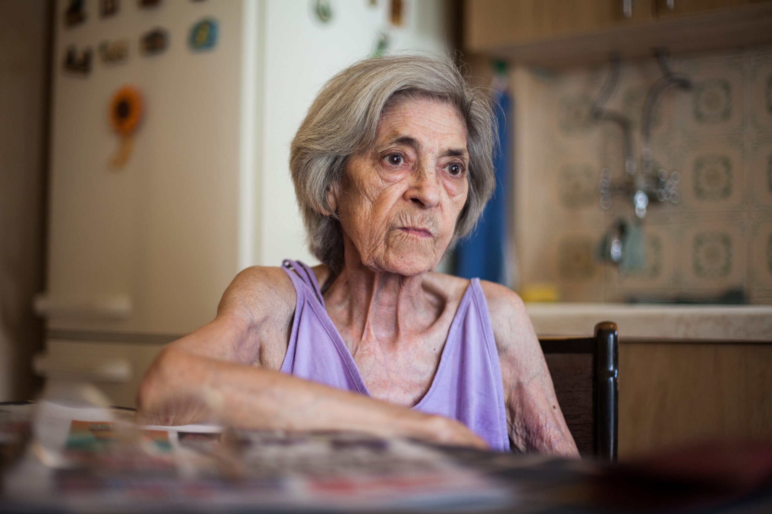 Hospice Eligibility for People With Dementia