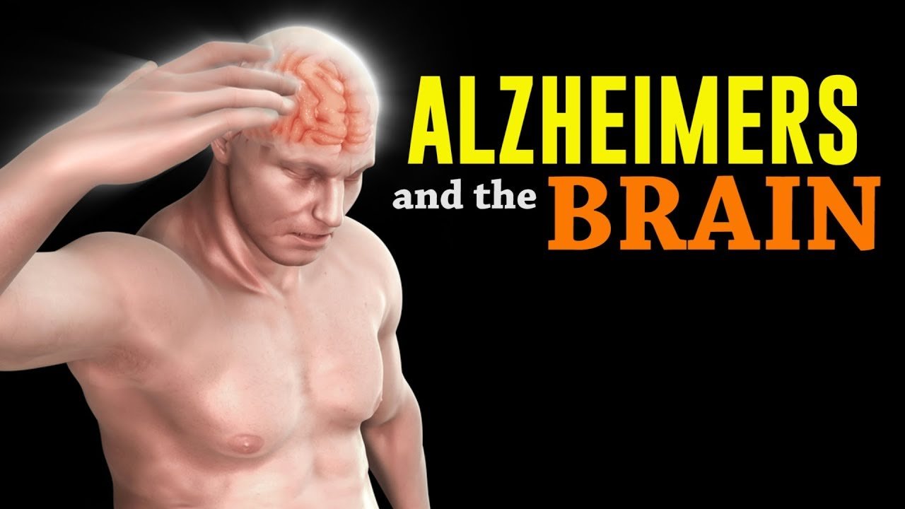 How Alzheimers Affects The Brain &  The Body (The SCARY ...