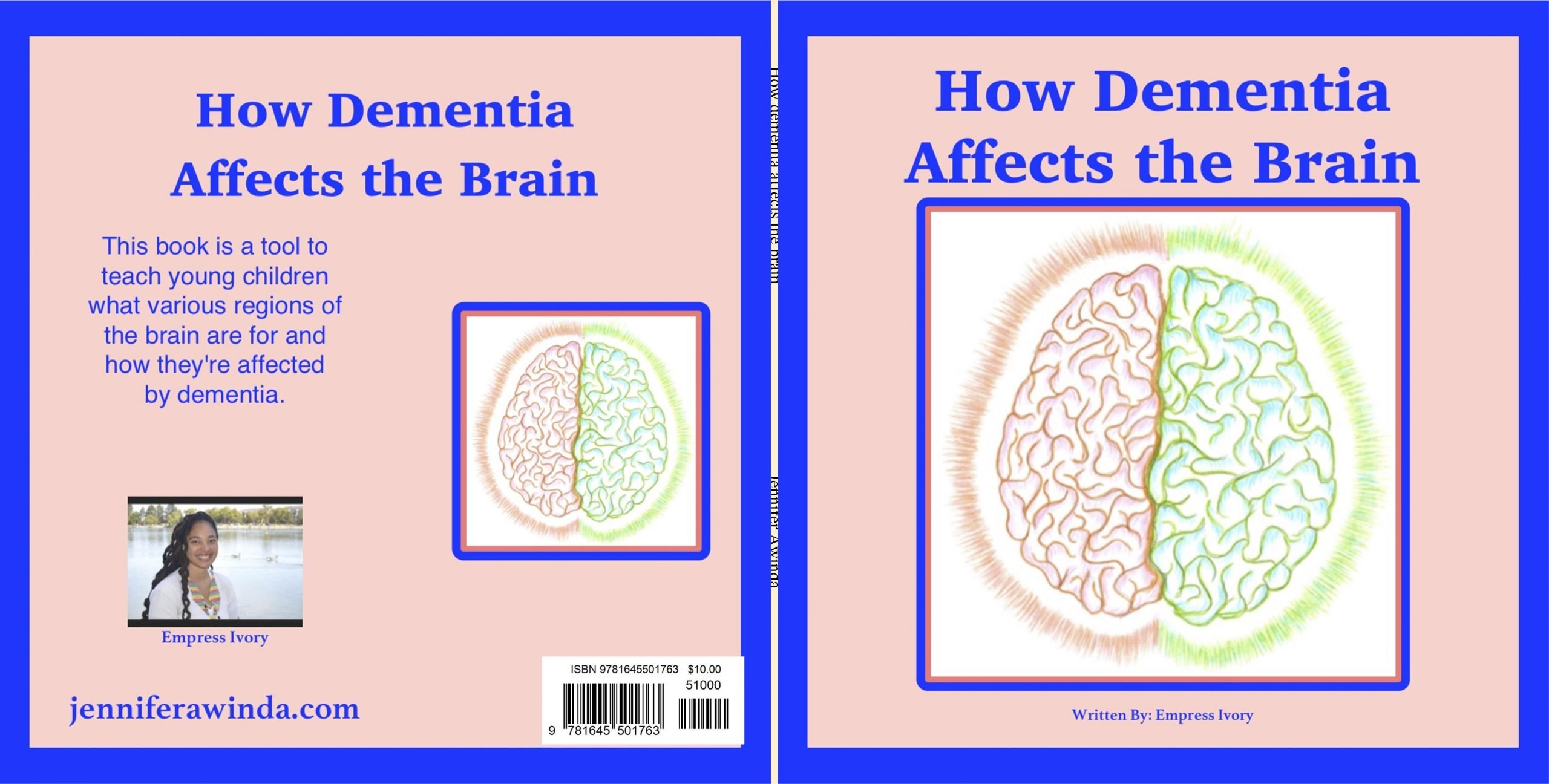 How dementia affects the brain by Jennifer Awinda : $10.00 ...