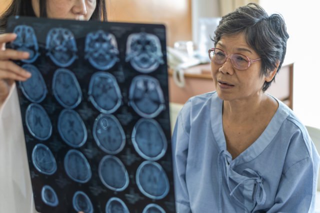 How To Diagnose Alzheimer