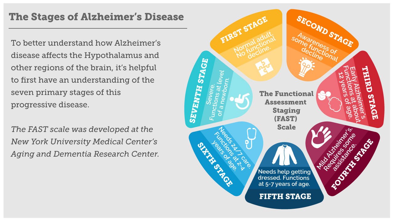 Impact of Alzheimer
