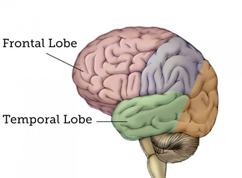 MÃ¡s de 25 ideas increÃbles sobre Frontal lobe dementia en ...