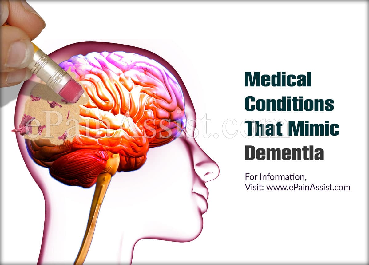 Medical Conditions That Mimic Dementia