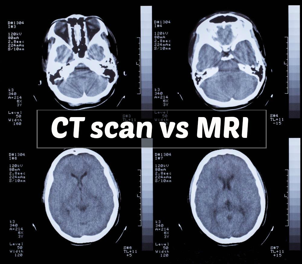 MRI and CT Scan Comparison and Their Roles in Personal ...