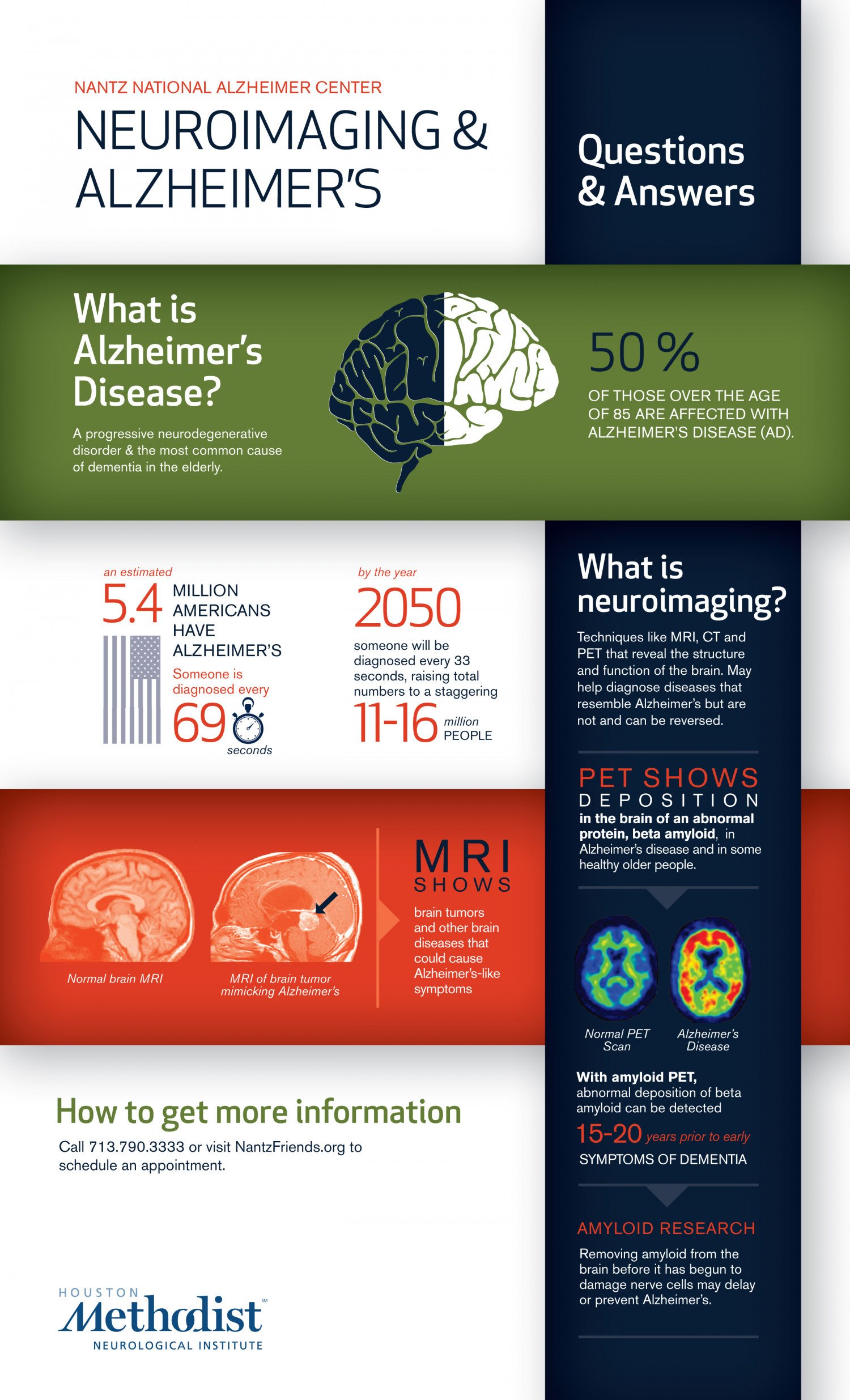 Neuroimaging &  Alzheimerâs: Questions &  answers Infographic