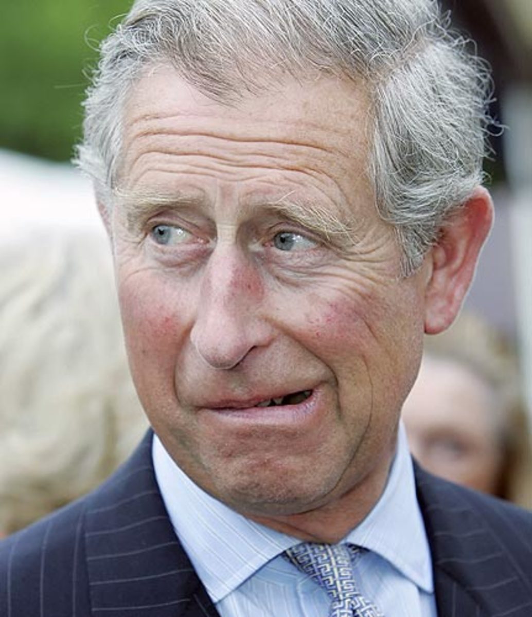 Prince Charles and Alzheimer