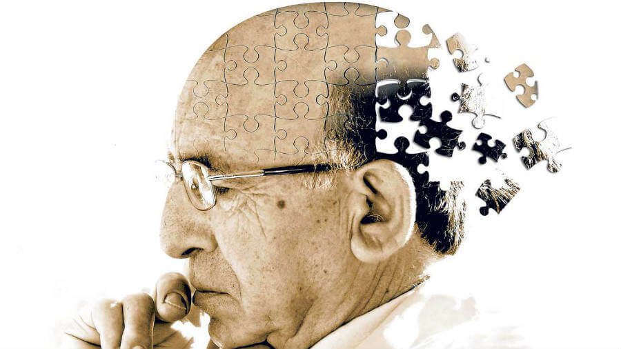 Silent Seizures Discovered in Patients with Alzheimers ...