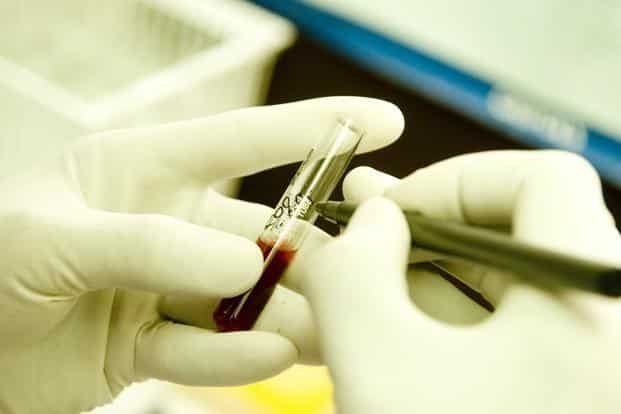 Simple blood test to predict Alzheimers