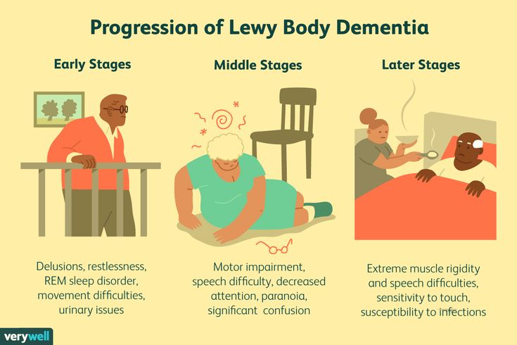 Stages and Progression of Lewy Body Dementia