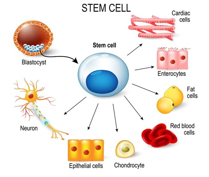 Stem Cell Therapy for Alzheimer