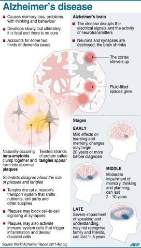 Technology to detect Alzheimer