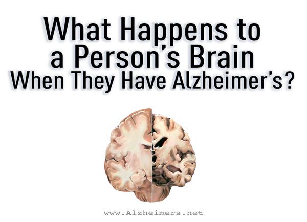 The most common form of dementia, Alzheimers disease ...