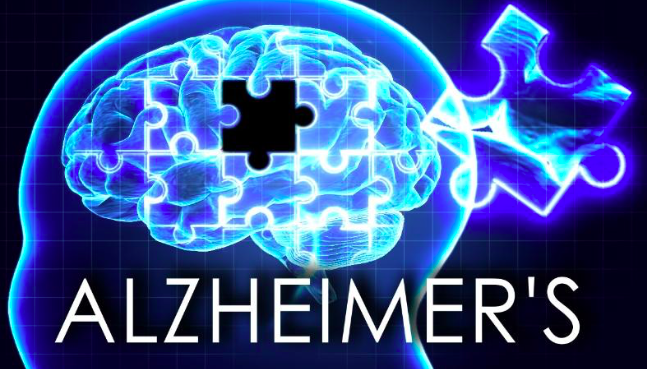 The Protocol that Could Slow Down Alzheimer