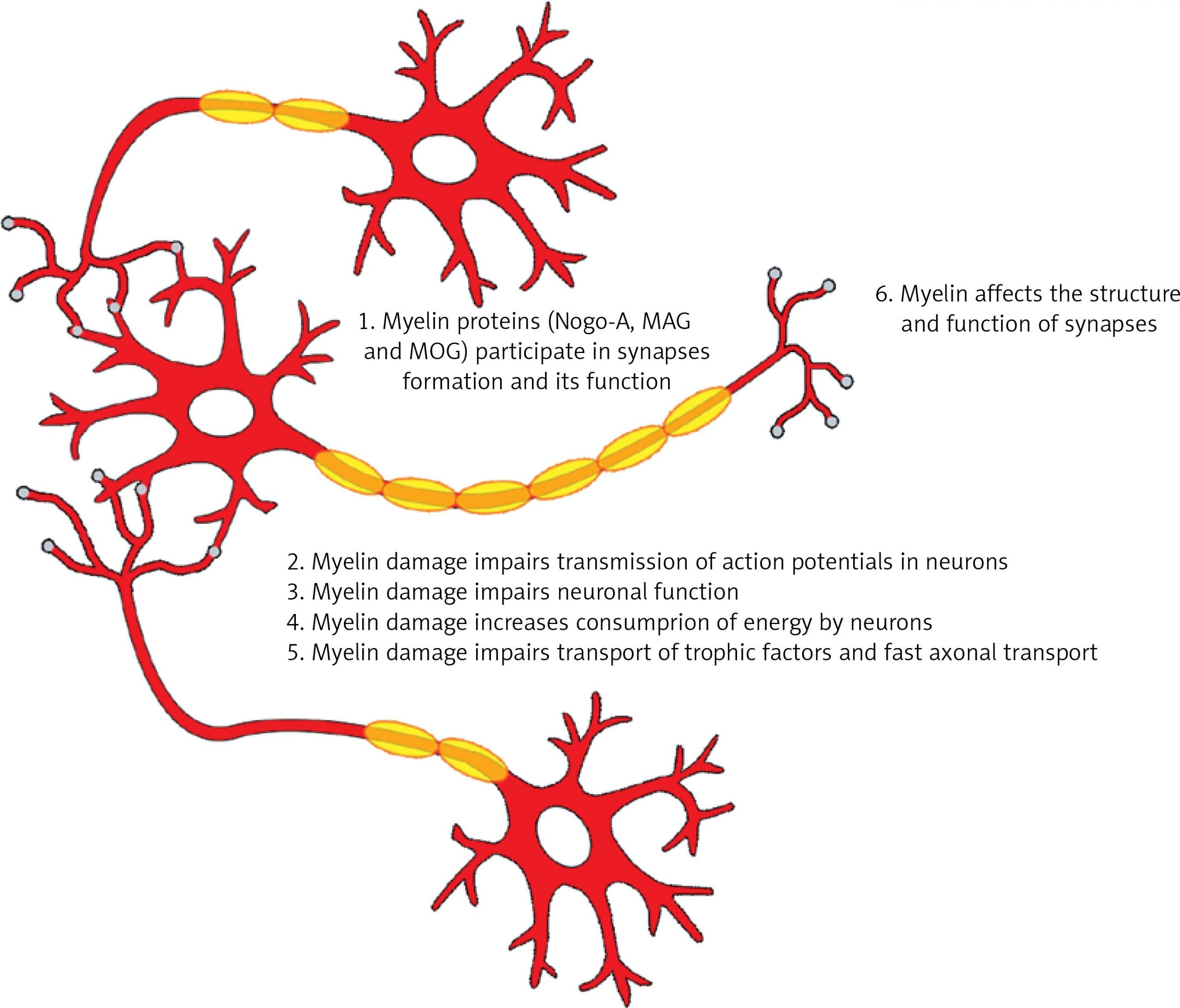 The role of myelin damage in Alzheimers disease pathology