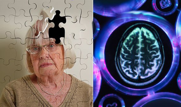 Vascular dementia: Six symptoms which could mean you have ...