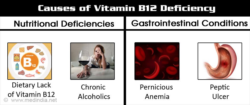 Vitamin B12 Deficiency