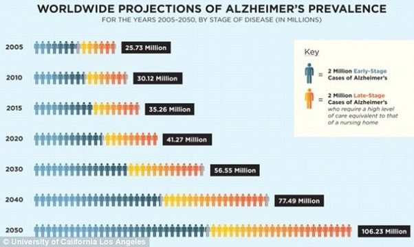 What age do most people get Alzheimer