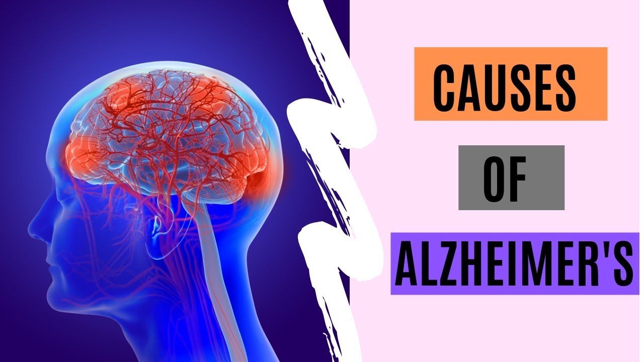 What Are The Causes Of Alzheimers?