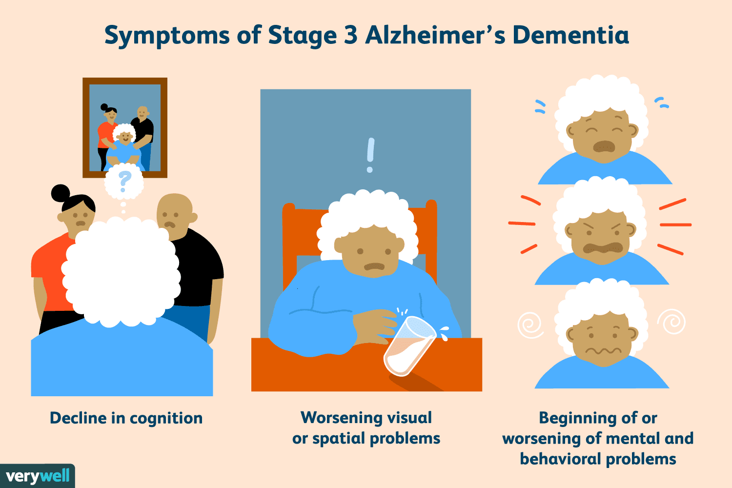 What Are the Stages of Alzheimers Dementia?