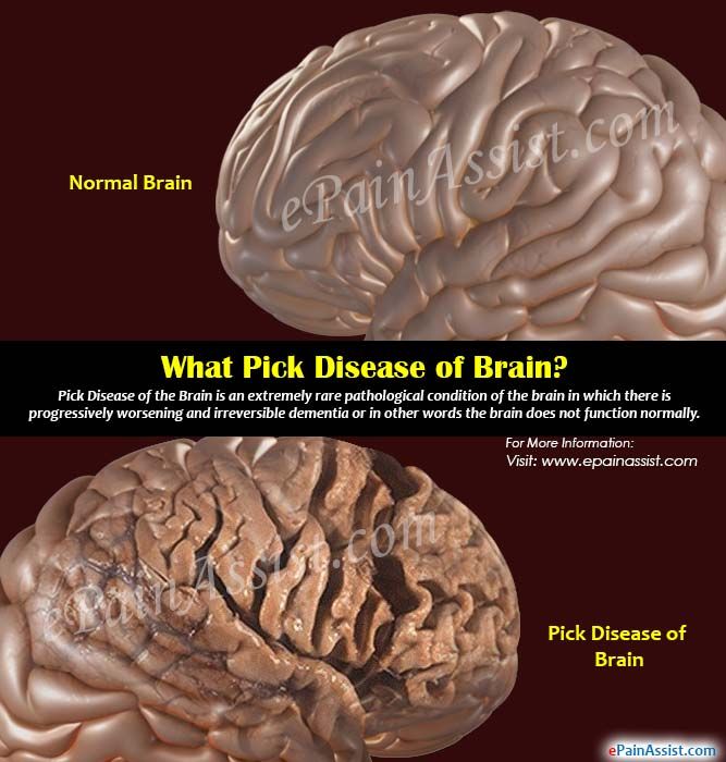What Is Dementia In The Brain