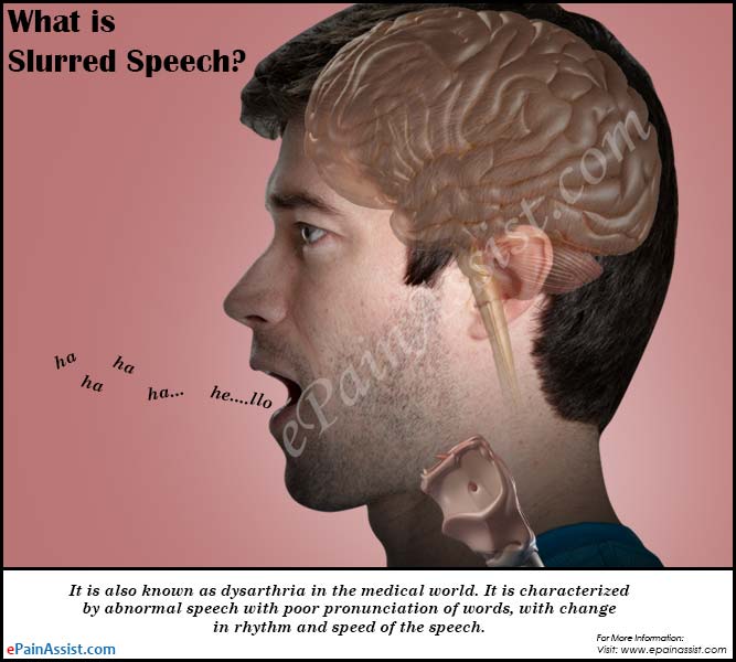 What is Slurred Speech &  How is it Treated?