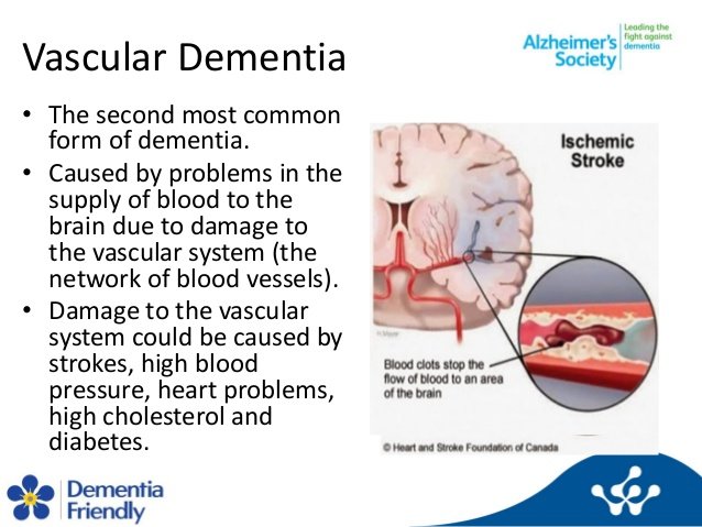 What is Vascular Dementia??