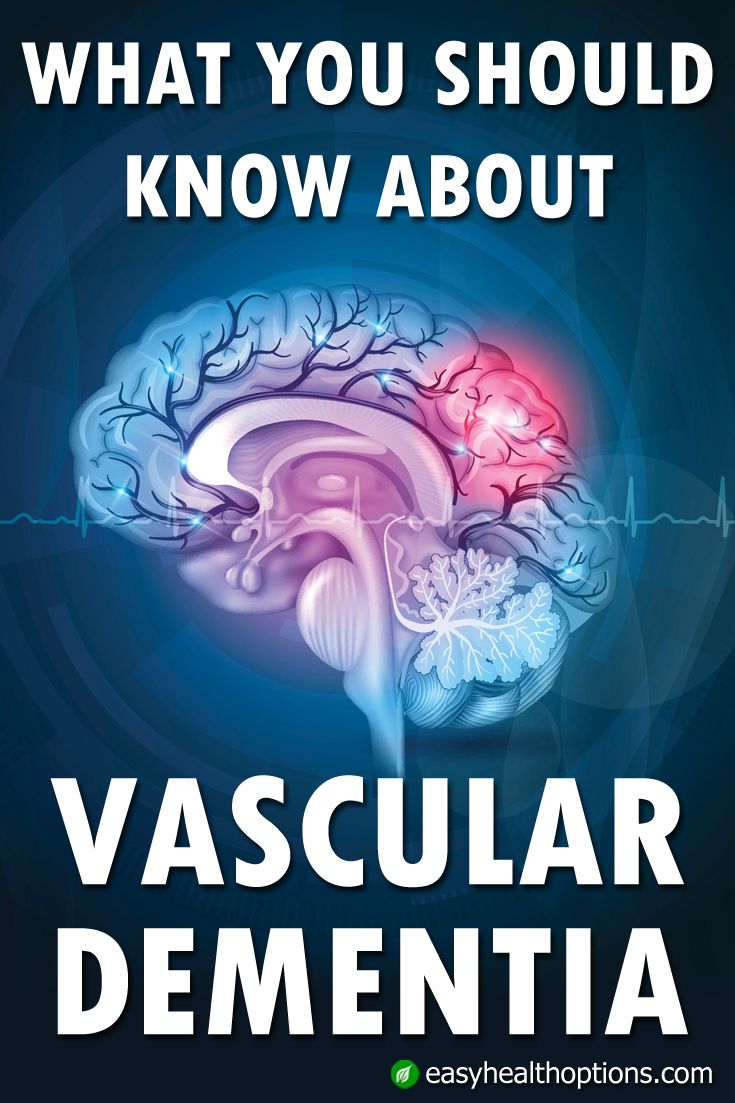 What you should know about vascular dementia