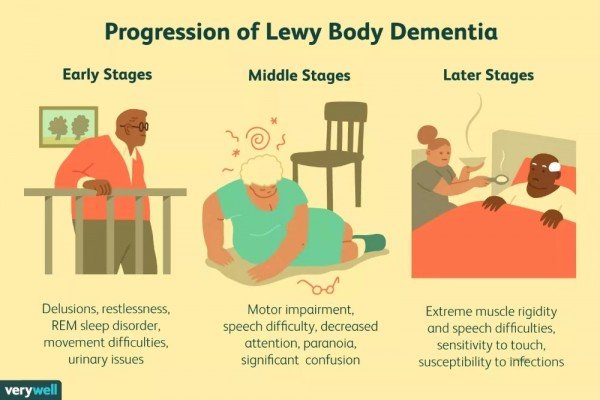 Why do people with Lewy Body Dementia just stop walking ...
